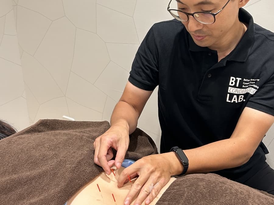 鍼灸マッサージイメージ